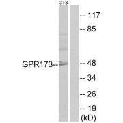 Western blot analysis of extracts from NIH-3T3 cells, using GPR173 antibody.
