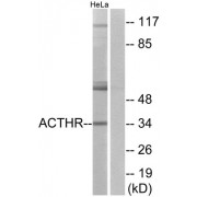 Western blot analysis of extracts from HeLa cells, using ACTHR antibody.