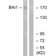 Western blot analysis of extracts from Jurkat cells, using BAI1 antibody.