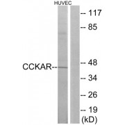 Western blot analysis of extracts from HUVEC cells, using CCKAR antibody.