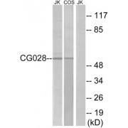 Western blot analysis of extracts from Jurkat cells and COS cells, using CG028 antibody.