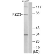 Western blot analysis of extracts from HUVEC cells, using FZD3 antibody.