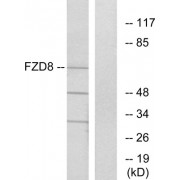 Western blot analysis of extracts from Jurkat cells, using FZD8 antibody.