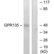 Western blot analysis of extracts from NIH-3T3 cells, using GPR135 antibody.