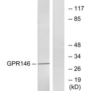 Western blot analysis of extracts from LOVO cells, using GPR146 antibody. The lane on the right is blocked with the synthesized peptide.