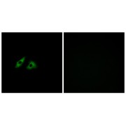 Immunofluorescence analysis of HeLa cells, using GPR152 antibody.