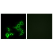 Immunofluorescence analysis of LOVO cells, using GPBAR antibody.