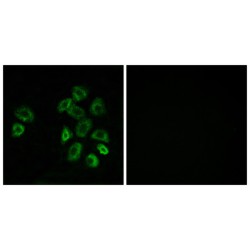 G Protein-Coupled Receptor Class C Group 5 Member B (GPRC5B) Antibody