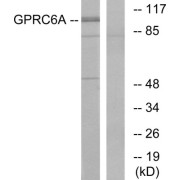 Western blot analysis of extracts from Jurkat cells, using GPC6A antibody.