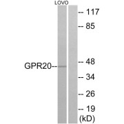 Western blot analysis of extracts from LOVO cells, using GPR20 antibody.