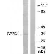 Western blot analysis of extracts from COLO cells, using GPR31 antibody.