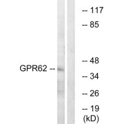 Western blot analysis of extracts from COLO cells, using GPR62 antibody.