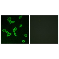 Leucine Rich Repeat Containing G Protein-Coupled Receptor 6 (LGR6) Antibody
