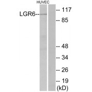 Western blot analysis of extracts from HUVEC cells, using LGR6 antibody.