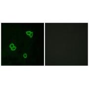 Immunofluorescence analysis of LOVO cells, using LPHN1 antibody.