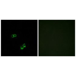 Melanocortin Receptor 5 (MC5R) Antibody