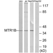 Western blot analysis of extracts from 293 cells, Jurkat cells and HepG2 cells, using MTR1B antibody.