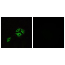 Neuromedin-B Receptor (NMBR) Antibody