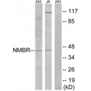Western blot analysis of extracts from 293 cells and Jurkat cells, using NMBR antibody.