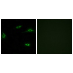 Olfactory Receptor Family 2 Subfamily T Member 11 (gene/pseudogene) (OR2T11) Antibody