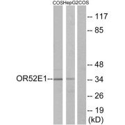 Western blot analysis of extracts from COS-7cells and HepG2 cells, using OR52E1 antibody.