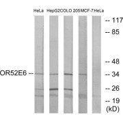 Western blot analysis of extracts from HeLa cells, HepG2 cells, COLO cells and MCF-7 cells, using OR52E6 antibody.