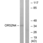 Western blot analysis of extracts from HeLa cells, using OR52N4 antibody.