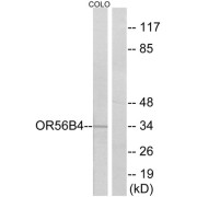 Western blot analysis of extracts from COLO cells, using OR56B4 antibody.