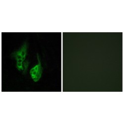 Opsin 5 (OPN5) Antibody