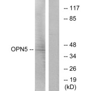 Western blot analysis of extracts from Jurkat cells, using OPN5 antibody.