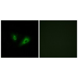 Putative Olfactory Receptor 10D4 (OR10D4) Antibody