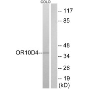 Western blot analysis of extracts from COLO cells, using OR10D4 antibody.