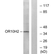 Western blot analysis of extracts from A549 cells, using OR10H2 antibody.