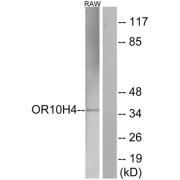 Western blot analysis of extracts from RAW264.7 cells, using OR10H4 antibody.