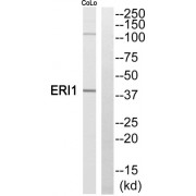 Western blot analysis of extracts from COLO205 cells, using ERI1 antibody.