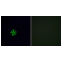 Olfactory Receptor Family 2 Subfamily G Member 2 (OR2G2) Antibody