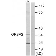 Western blot analysis of extracts from Jurkat cells, using OR3A2 antibody.