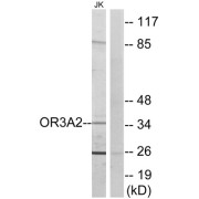 Western blot analysis of extracts from Jurkat cells, using OR3A2 antibody.