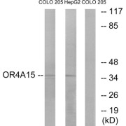Western blot analysis of extracts from COLO cells and HepG2 cells, using OR4A15 antibody.