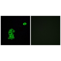 Olfactory Receptor Family 4 Subfamily C Member 6 (OR4C6) Antibody