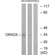 Western blot analysis of extracts from HeLa cells and HepG2 cells, using OR4C6 antibody.