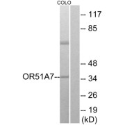 Western blot analysis of extracts from COLO cells, using OR51A7 antibody.