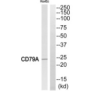 Western blot analysis of extracts from HuvEc cells, using CD79A antibody.