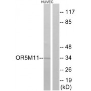 Western blot analysis of extracts from HUVEC cells, using OR5M11 antibody.