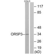 Western blot analysis of extracts from COLO cells, using OR5P3 antibody.