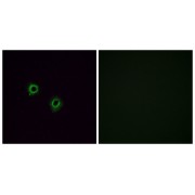 Immunofluorescence analysis of A549 cells, using OR2J3 antibody. The picture on the right is blocked with the synthesized peptide.