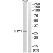 Western blot analysis of extracts from HuvEc cells, using THY1 antibody.