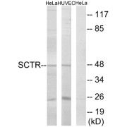 abx015475