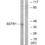 Western blot analysis of extracts from COS-7 cells, using SSTR1 antibody.