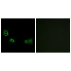 Transmembrane Protein 185A (TMEM185A) Antibody
